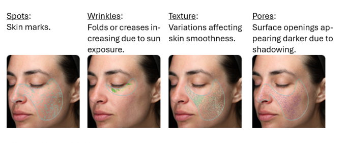 VISIA-CR spots, wrinkles, texture, pores, UV spots, brown spots, red areas and porphyrins.